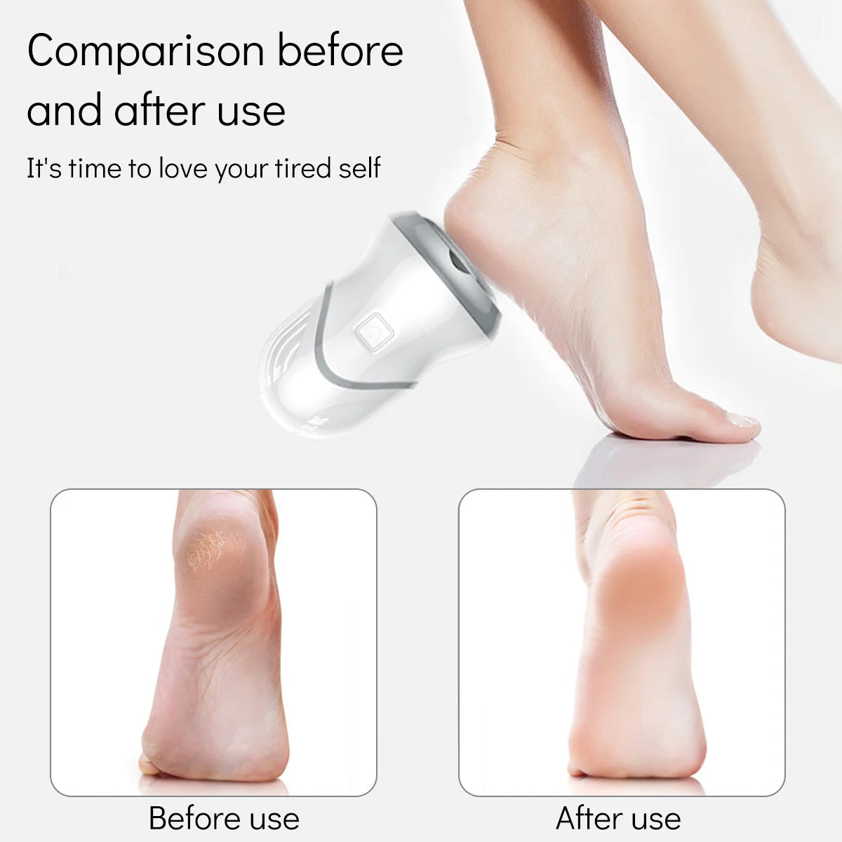 SmoothSole Pro: Electric Portable Callus Remover & Vacuum Foot Grinder